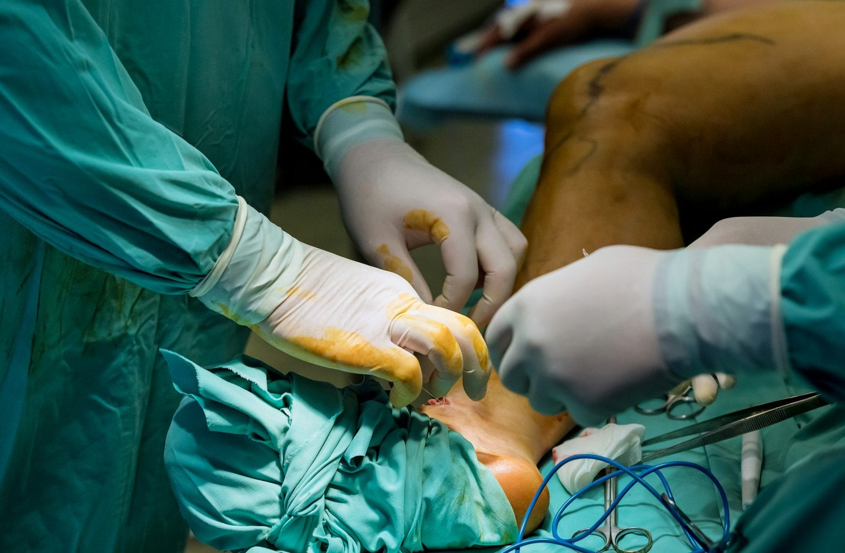 Orthopedic surgeons are skilled in performing operations on the leg to treat various injuries.