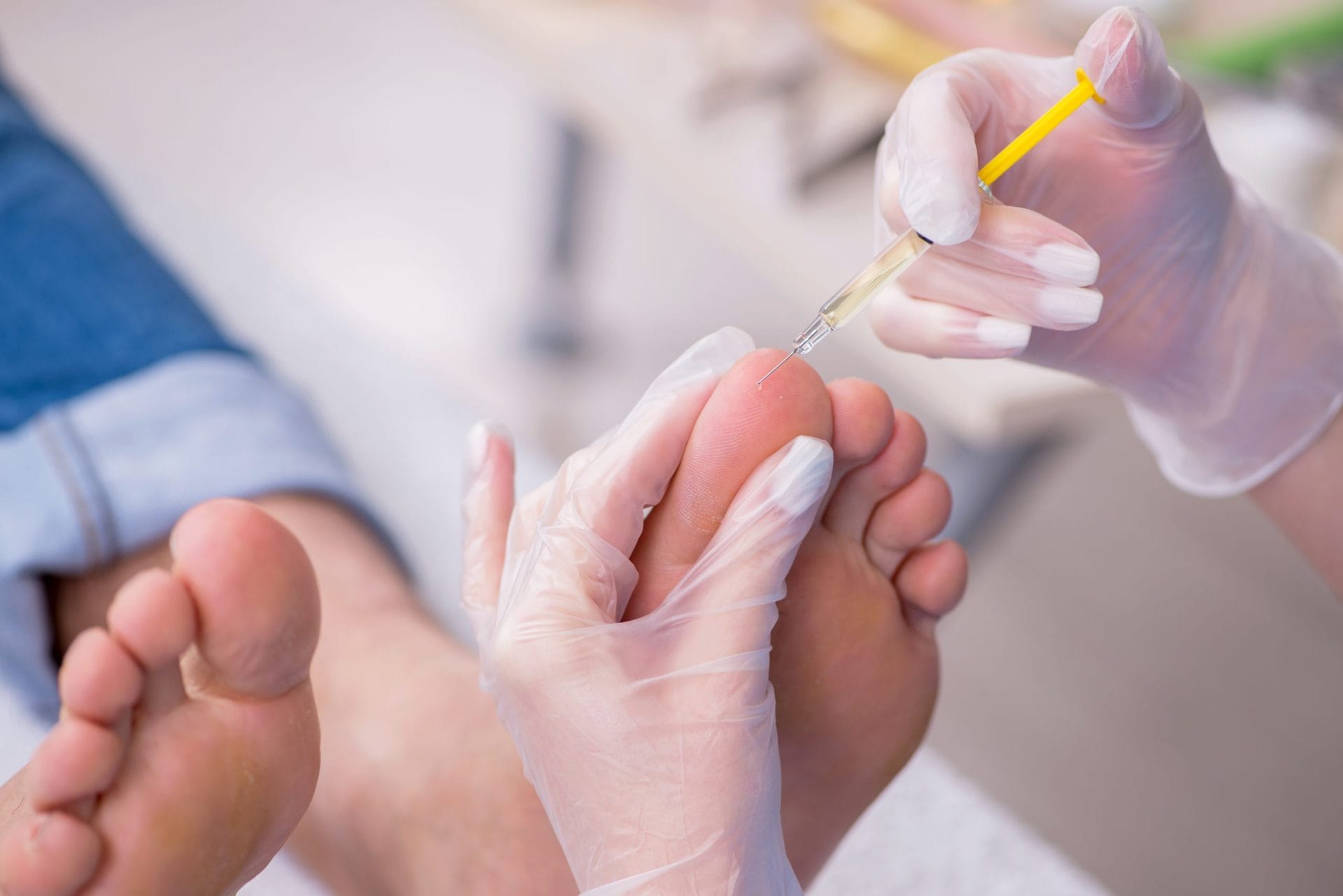 Podiatrist treating feet during the procedure